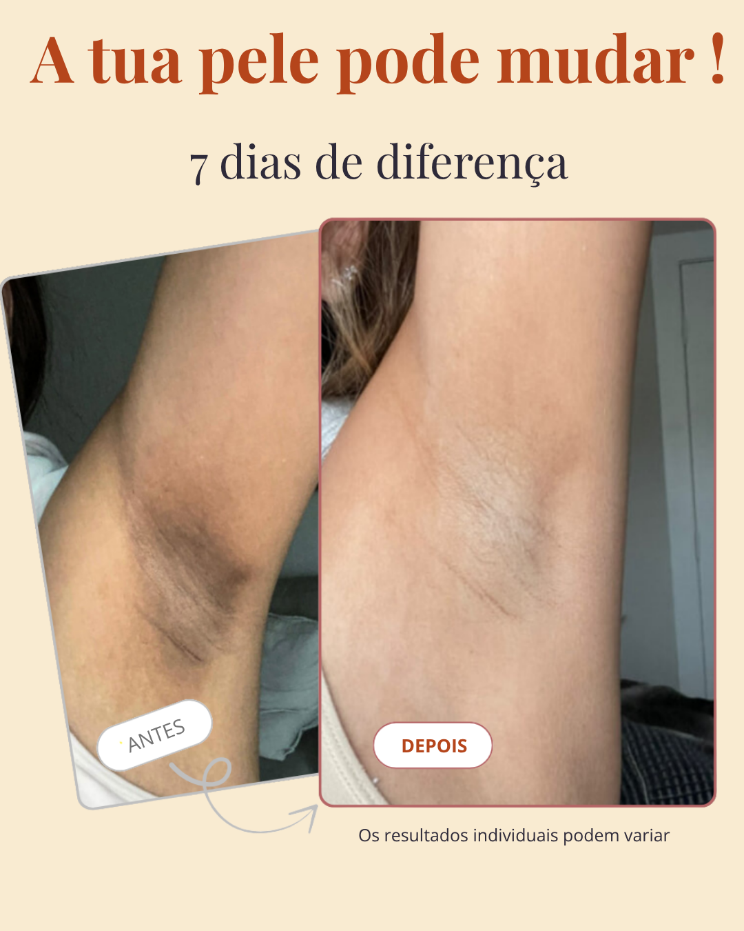 Spray Corporal de Cúrcuma — ADEUS MANCHAS NAS AXILAS, JOELHOS E COTOVELOS