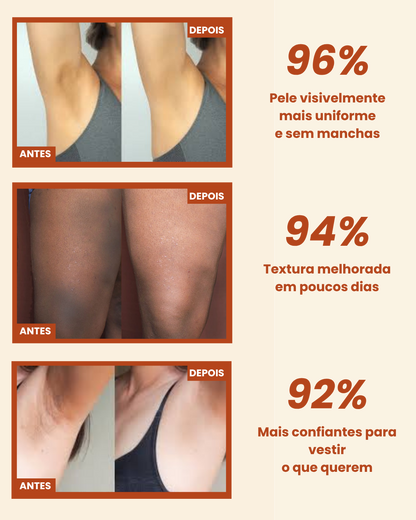 Spray Corporal de Cúrcuma — ADEUS MANCHAS NAS AXILAS, JOELHOS E COTOVELOS
